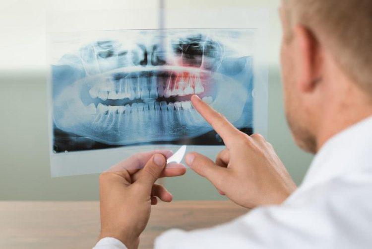 MUTUELLE DENTAIRE SANS PLAFOND